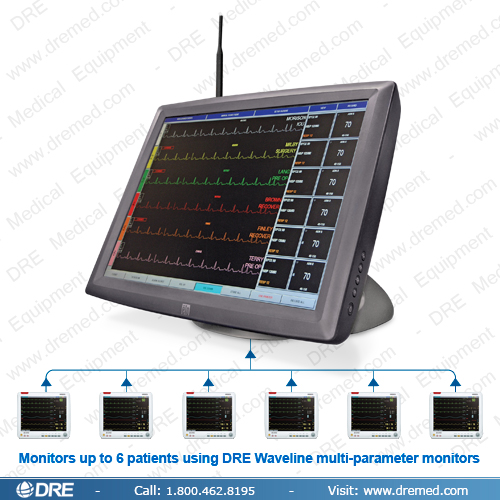 DRE Envoy PDM with Waveline Monitors