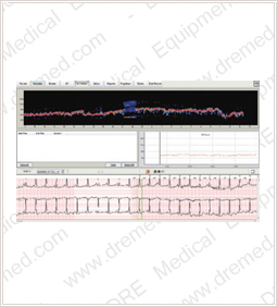 DRE Sage 12c atrial fibrillation analysis