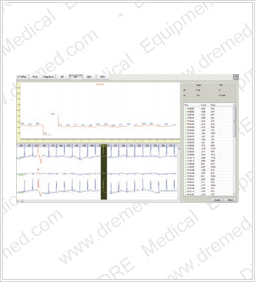 DRE Sage 12c heart rate turbulence analysis