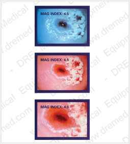 Images from Welch Allyn Video Colposcope