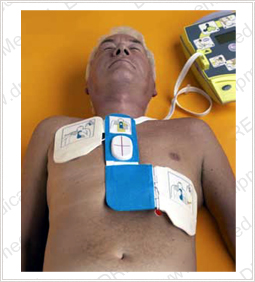 Zoll AED Plus Defibrillator - In Use on Patient